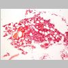 Medula osea HE 09.jpg
